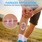 Antaly Emergency Wound Closure Strips – Waterproof