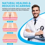 Antaly Emergency Wound Closure Strips – Waterproof